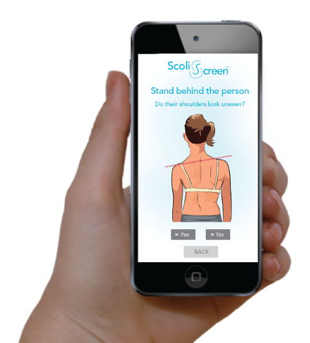 Online screening for the signs of scoliosis